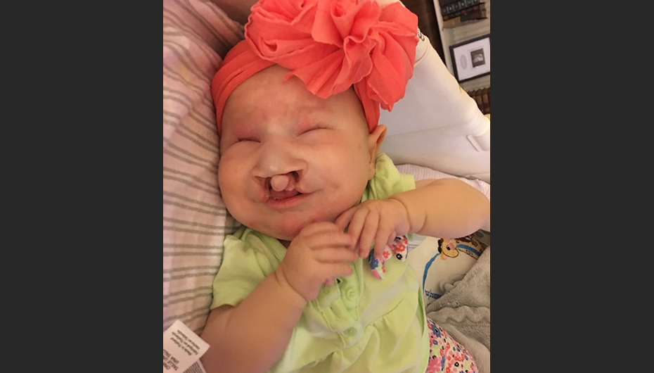 Local Shriner's offer to help Nora Rose